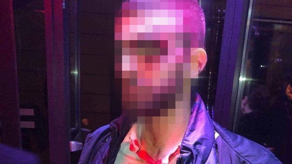 Άγριο ξύλο στο μαγαζί που τραγουδά ο Σαμπάνης: Πήγε να βοηθήσει τον φίλο του και παραλίγο να χάσει το μάτι του (εικόνα, βίντεο)